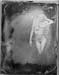 collodion017